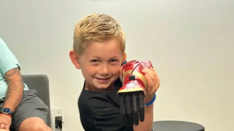 PA Boy showing his prosthetic arm to the camera