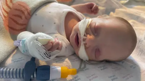 UK Health Security Agency A three week old baby lying on a blanket in hospital with medical tubes up her nose. She has her eyes closed and her arms up by her side 