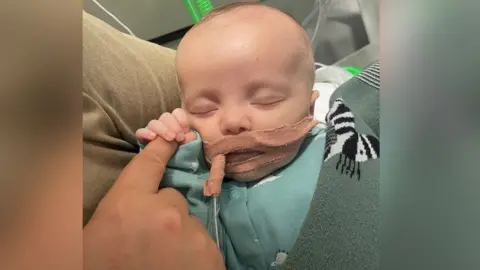  Jones family/PA Wire A baby with tubes in his mouth holding an adult's finger