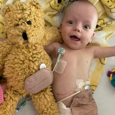 Bradford family Baby Zachary in a hospital cot with monitors attached and lying beside a big yellow teddy bear