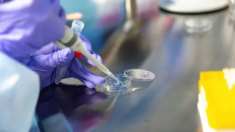 Getty Images KYIV, UKRAINE - 2023/02/23: An embryologist, Oksana Lyzohub prepares reproductive cells in an IVF lab in 'IVMED' Fertility Center in central Kiev. IVMED Fertility Center offers semen cryopreservation (sperm freezing) to the Ukrainian Armed Forces free of charge. The programme aim is to preserve the sperm in case of reproductive health problems caused by injury or in case of death. As the full scale invasion of Ukraine by the Russian forces approaches its first anniversary there are many governmental and business projects that help the servicemen and women in their daily needs. (Photo by Dominika Zarzycka/SOPA Images/LightRocket via Getty Images)