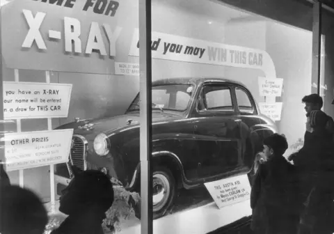 Getty Images A window display with an Austin A35 car and a sign reading 'if you have an x-ray your name will be entered in a draw for this car'